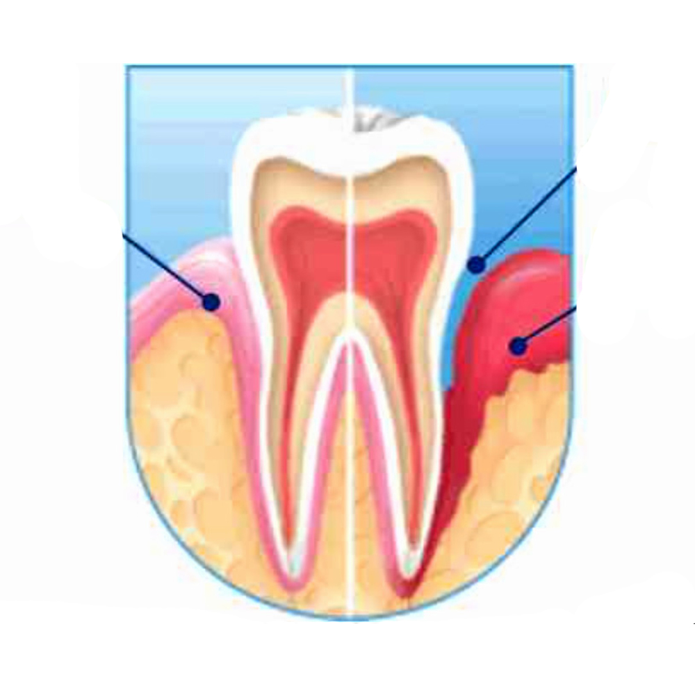 periodoncia